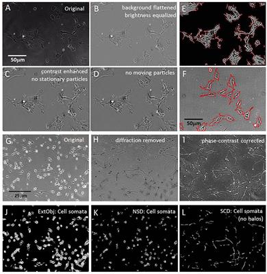 Quantitative Determination of Cellular-and Neurite Motility Speed in Dense Cell Cultures